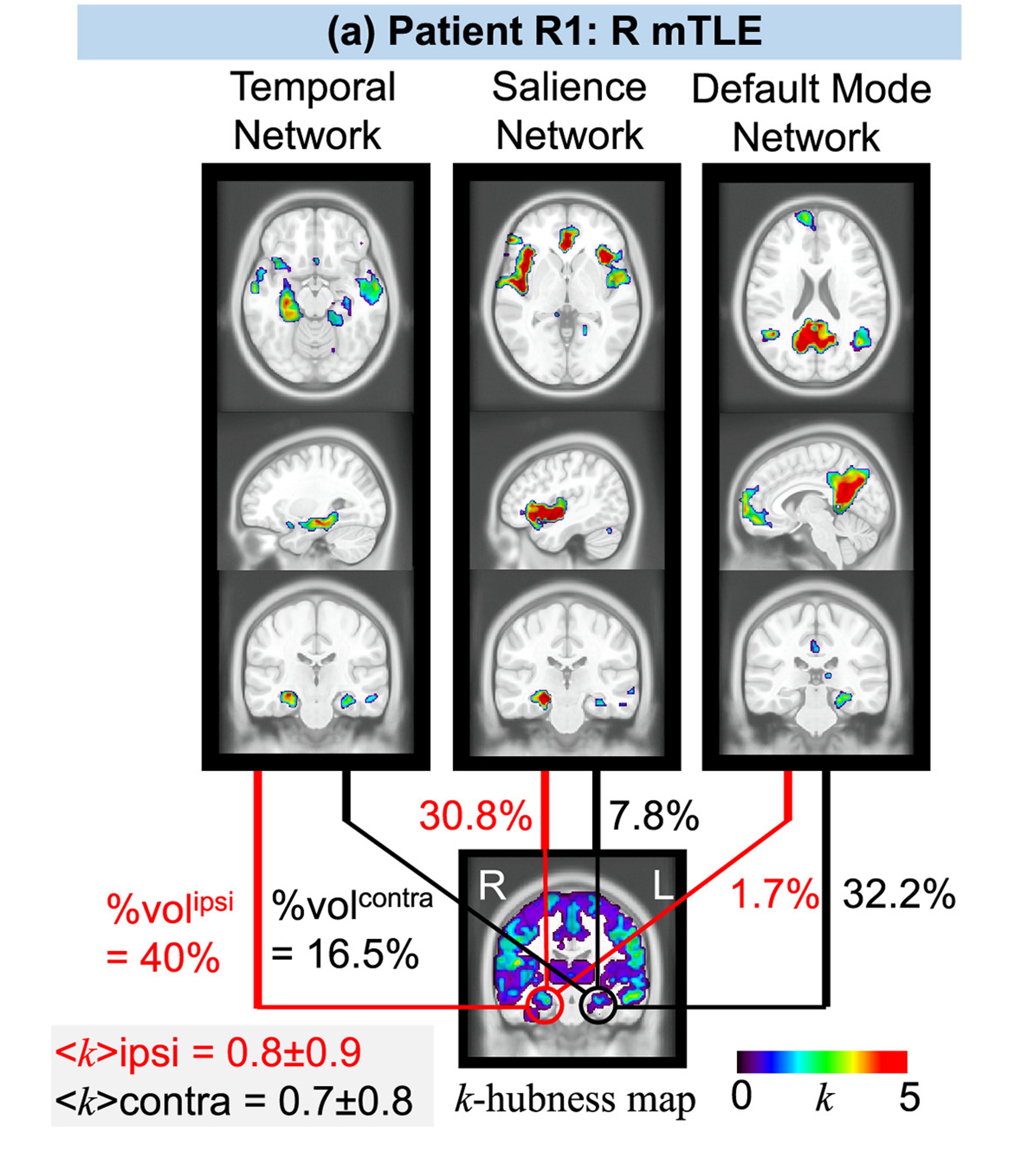 Functional Neuroimaging Illustration